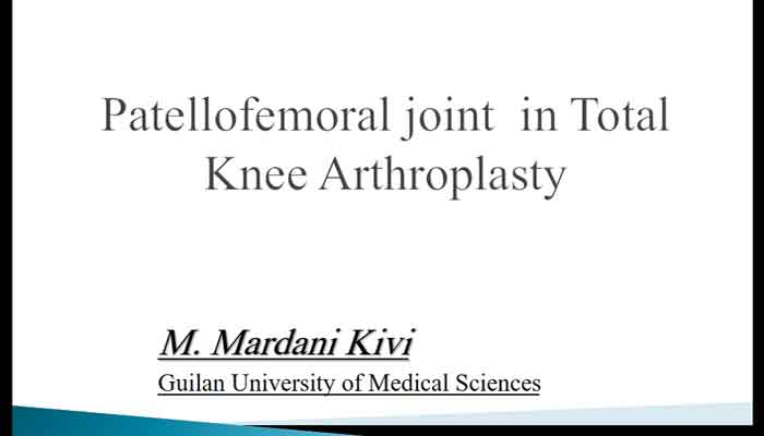 Patellofemoral joint  in Total Knee Arthroplasty