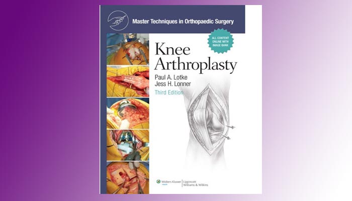 Knee Arthroplasty