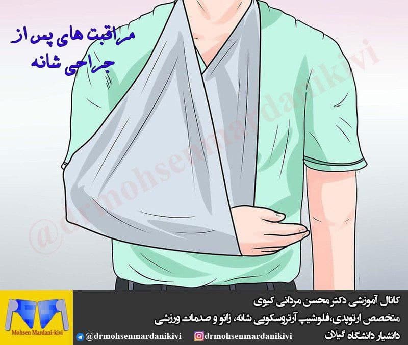 مراقبت های پس از جراحی شانه