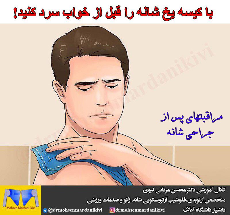 مراقبت های پس از جراحی شانه