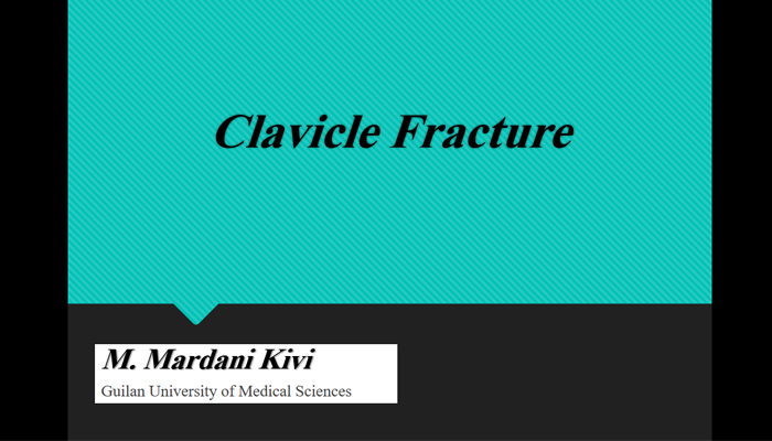 Clavicle Fracture