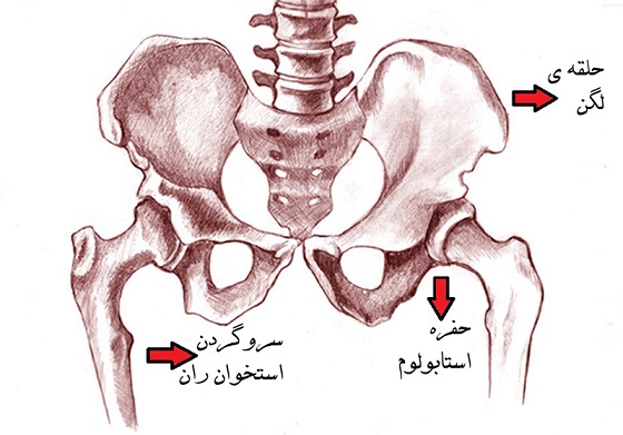 شکستگی لگن