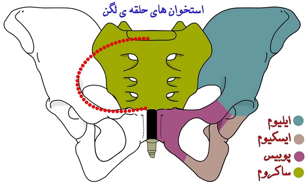 شکستگی حلقه لگن