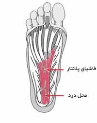 فاشیای پلانتار