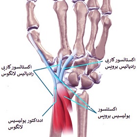 سندروم تقاطع