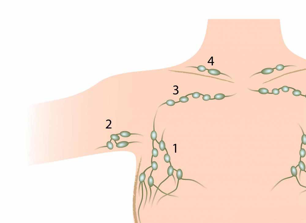 آناتومی بالینی لنفاتیک اندام فوقانی 