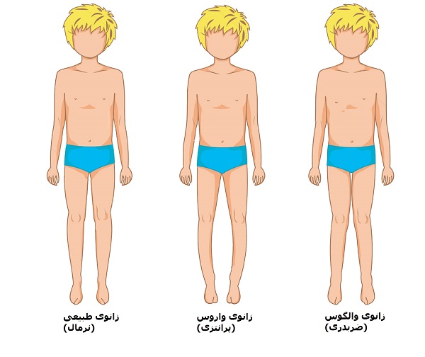 بیماری بلانت