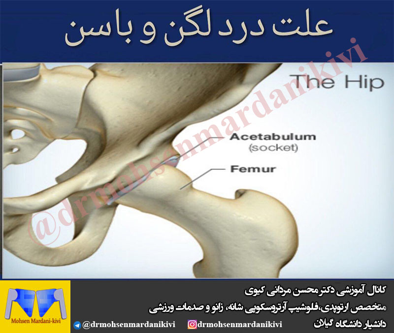 چرا بعضی از افراد با درد لگن و باسن دچار اختلال در فعالیت روزانه میشوند؟ 