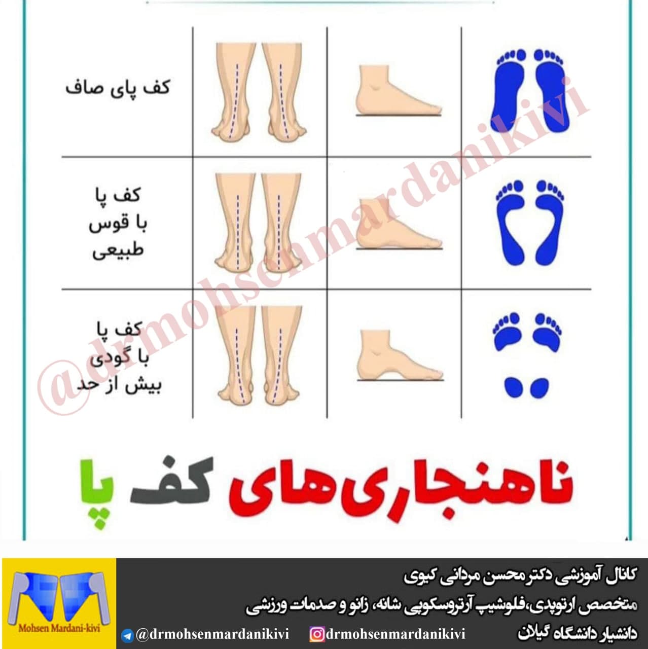 ناهنجاری های کف پا