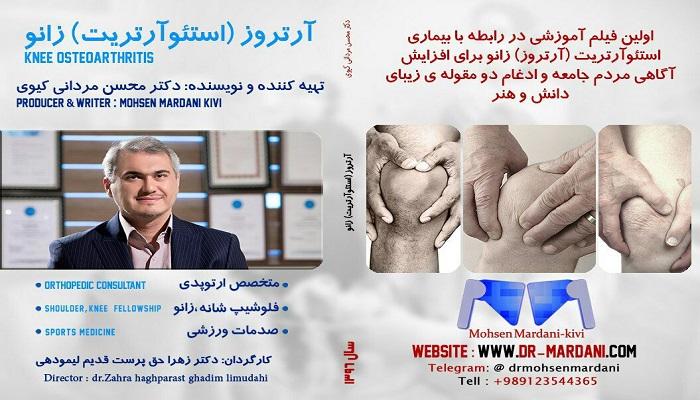 اکران خصوصی فیلم مستند آرتروز (استئوآرتریت) زانو